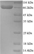 Recombinant Human Cholinesterase (BCHE) – Figure 1 of 1
