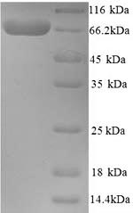 Recombinant Human Cholinesterase (BCHE) – Figure 1 of 1