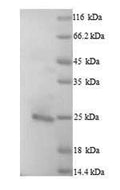 Recombinant Human Bcl-2-like protein 11 (BCL2L11) – Figure 1 of 1