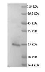 Recombinant Human Bcl-2-like protein 11 (BCL2L11) – Figure 1 of 1