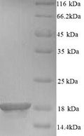 Recombinant Mouse Baculoviral IAP repeat-containing protein 5 (Birc5) – Figure 1 of 1
