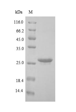 Recombinant Human BCL2/adenovirus E1B 19KDA protein-interacting protein 3-like (BNIP3L) – Figure 1 of 1