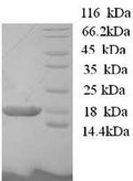 Recombinant Human BolA-like protein 1 (BOLA1) – Figure 1 of 1