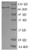 Recombinant Human Tyrosine-protein kinase BTK (BTK) – Figure 1 of 1