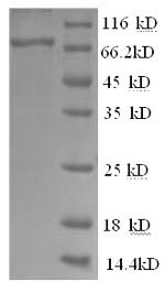 Recombinant Human Tyrosine-protein kinase BTK (BTK) – Figure 1 of 1