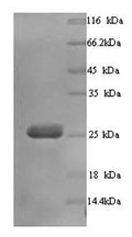 Recombinant Human Butyrophilin subfamily 3 member A3 (BTN3A3), partial – Figure 1 of 1