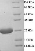 Recombinant Mouse Complement C1q subcomponent subunit A (C1qa) – Figure 1 of 1