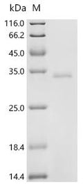 (Tris-Glycine gel) Discontinuous SDS-PAGE (reduced) with 5% enrichment gel and 15% separation gel.