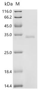 (Tris-Glycine gel) Discontinuous SDS-PAGE (reduced) with 5% enrichment gel and 15% separation gel.