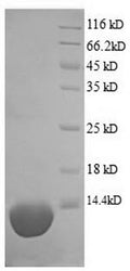 Recombinant Pig Complement C5a anaphylatoxin (C5) – Figure 1 of 1