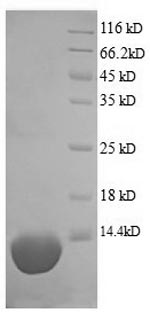 Recombinant Pig Complement C5a anaphylatoxin (C5) – Figure 1 of 1