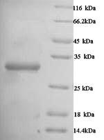 Recombinant Human Carbonic anhydrase 1 (CA1) – Figure 1 of 1