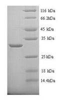 Recombinant Rat Carbonic anhydrase 1 (Ca1) – Figure 1 of 1