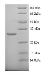 Recombinant Rat Carbonic anhydrase 1 (Ca1) – Figure 1 of 1