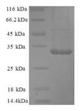 Recombinant Human Carbonic anhydrase 12 (CA12), partial – Figure 1 of 1