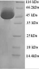 Recombinant Mouse Calreticulin (Calr) – Figure 1 of 1
