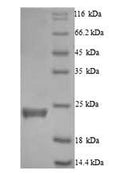 Recombinant Human Caspase-5 (CASP5), partial – Figure 1 of 1