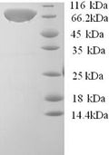 Recombinant Human Calpastatin (CAST) – Figure 1 of 1