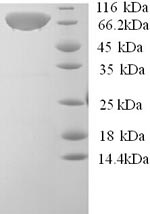 Recombinant Human Calpastatin (CAST) – Figure 1 of 1