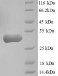 Recombinant Human Carbonyl reductase [NADPH] 1 (CBR1) – Figure 1 of 1