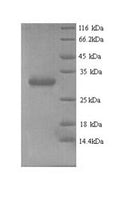 Recombinant Human Chromobox protein homolog 7 (CBX7) – Figure 1 of 1