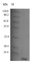 Recombinant Human C-C motif chemokine 8 (CCL8) – Figure 1 of 1