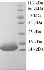 Recombinant Human Cyclin-J-like protein (CCNJL), partial – Figure 1 of 1