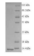 Recombinant Mouse C-C chemokine receptor type 5 (Ccr5), partial – Figure 1 of 1