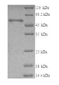 Recombinant Human T-complex protein 1 subunit beta (CCT2) – Figure 1 of 1
