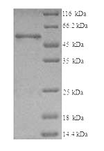 Recombinant Human T-complex protein 1 subunit beta (CCT2) – Figure 1 of 1