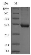 (Tris-Glycine gel) Discontinuous SDS-PAGE (reduced) with 5% enrichment gel and 15% separation gel.