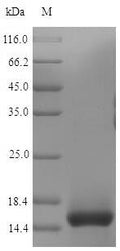 (Tris-Glycine gel) Discontinuous SDS-PAGE (reduced) with 5% enrichment gel and 15% separation gel.