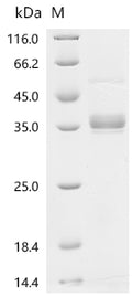 (Tris-Glycine gel) Discontinuous SDS-PAGE (reduced) with 5% enrichment gel and 15% separation gel.