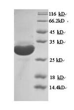 Recombinant Mouse Macrosialin (Cd68), partial – Figure 1 of 1