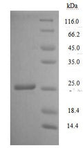 Recombinant Human T-cell antigen CD7 (CD7), partial – Figure 1 of 1