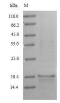Recombinant Human CD70 antigen (CD70), partial – Figure 1 of 1