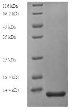 Recombinant Human CD81 antigen (CD81), partial – Figure 1 of 1
