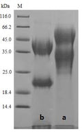 (Tris-Glycine gel) Discontinuous SDS-PAGE (reduced) with 5% enrichment gel and 15% separation gel.