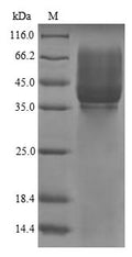 The reducing (R) protein migrates as 43 kDa in SDS-PAGE may be due to glycosylation.