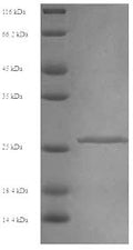 Recombinant Mouse Chymotrypsin-like elastase family member 2A (Cela2a) – Figure 1 of 1