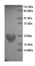 Recombinant Mouse Histone H3-like centromeric protein A (Cenpa) – Figure 1 of 1