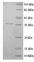 Recombinant Rat Muscarinic acetylcholine receptor M1 (Chrm1), partial – Figure 1 of 1