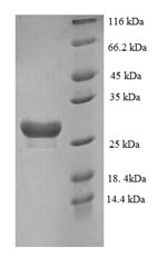 Recombinant Human Muscarinic acetylcholine receptor M3 (CHRM3), partial – Figure 1 of 1