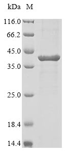 (Tris-Glycine gel) Discontinuous SDS-PAGE (reduced) with 5% enrichment gel and 15% separation gel.
