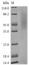 (Tris-Glycine gel) Discontinuous SDS-PAGE (reduced) with 5% enrichment gel and 15% separation gel.