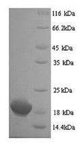 Recombinant Human Clathrin heavy chain 2 (CLTCL1), partial – Figure 1 of 1