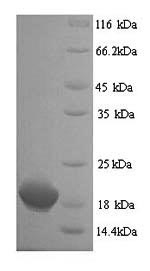 Recombinant Human Clathrin heavy chain 2 (CLTCL1), partial – Figure 1 of 1
