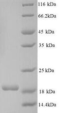 Recombinant Human Connector enhancer of kinase suppressor of ras 2 (CNKSR2), partial – Figure 1 of 1