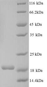Recombinant Human Connector enhancer of kinase suppressor of ras 2 (CNKSR2), partial – Figure 1 of 1