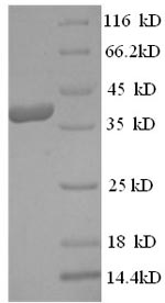 Recombinant Human Mast cell carboxypeptidase A (CPA3) – Figure 1 of 1